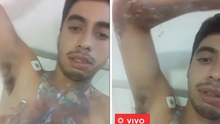 El joven que fue alcanzado por un rayo habló por primera vez: «En ese momento no sentí nada..»