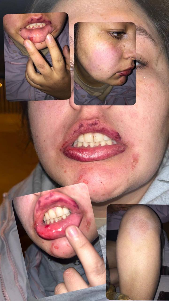 Una joven  denunció a su ex pareja por violencia extrema: “Si me pasa algo, yo no me maté”