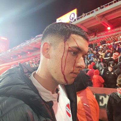 Incidentes y suspensión en Avellaneda: el partido entre Independiente y Universidad de Chile terminó en un escándalo