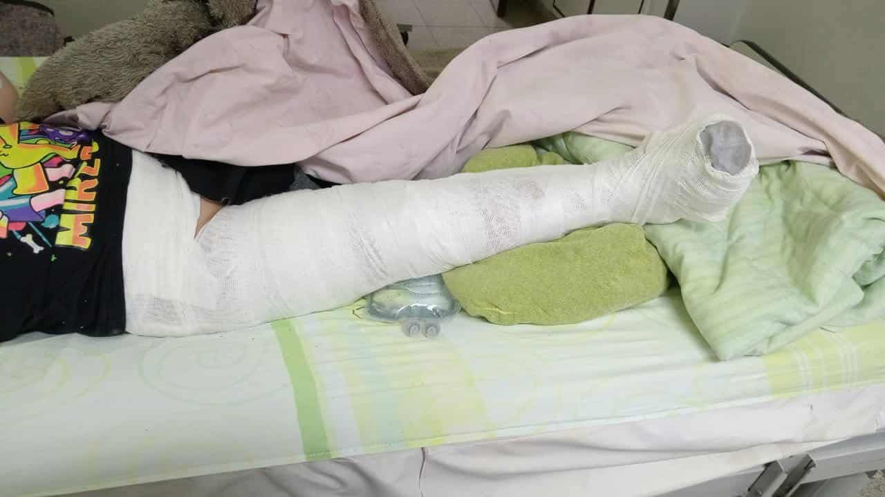 Un niño de 6 años resultó herido tras caer de un paredón en barrio céntrico