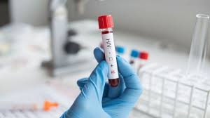 Argentina deja de financiar la prevención de VIH pese a que hay 17 infecciones por día