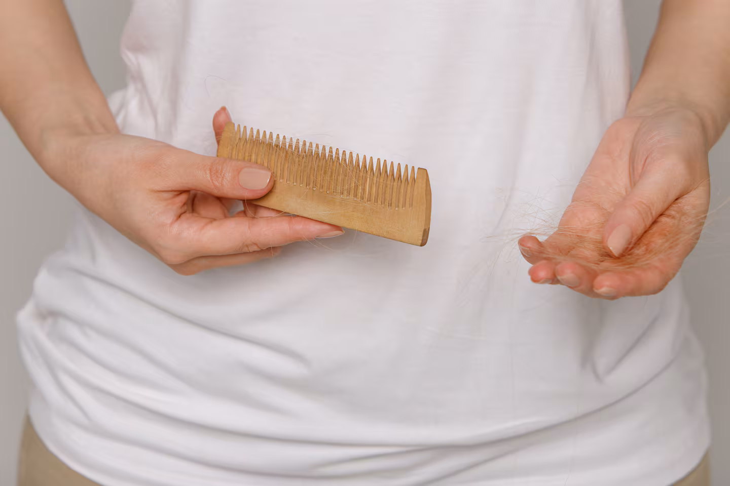 Especialistas explican: 5 estrategias para reducir el impacto de la alopecia