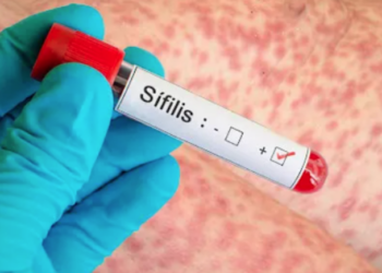 Preocupación por el aumento de casos de sífilis en Argentina