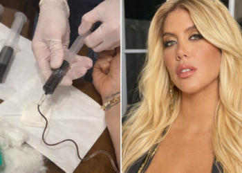 Wanda Nara compartió su tratamiento contra la leucemia
