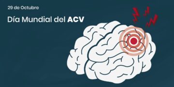 Día Mundial del ACV: cuáles son las señales de alarma y por qué actuar rápido puede salvar vidas