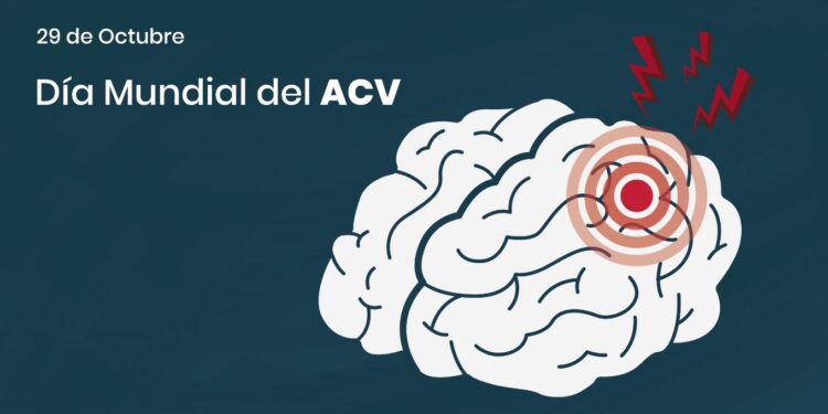 Día Mundial del ACV: cuáles son las señales de alarma y por qué actuar rápido puede salvar vidas