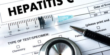 Hepatitis C, habría entre 700 y 800 casos nuevos al año en Argentina